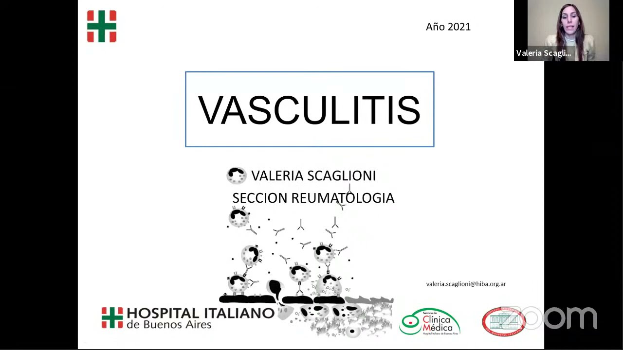 CECLIMI ProSAMed Vasculitis  Dra. Valeria Scaglioni