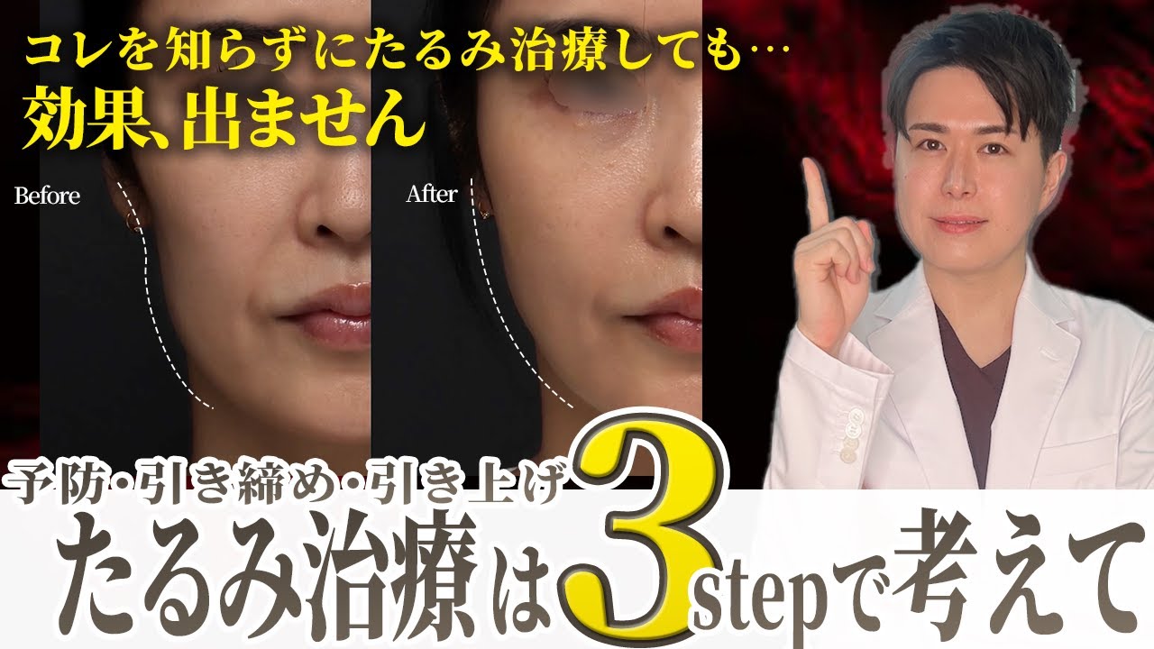 たるみ施術を金ドブにしない為に。HIFU・RF・ショートスレッド・糸リフト、効果をしっかり感じたいならたるみの３ステップを攻略して正しく施術を受けましょう！