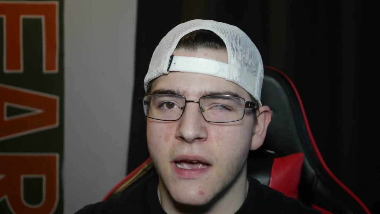 How I Drive Being Blind In One Eye
