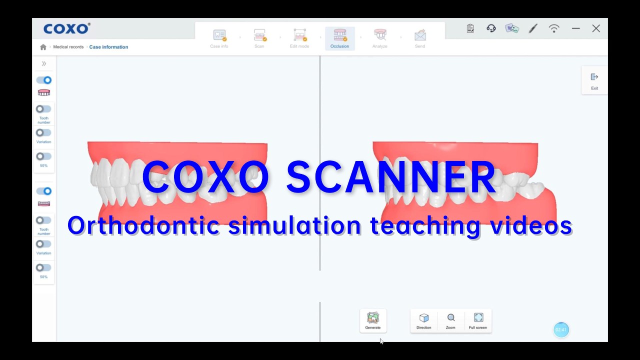 【COXO SCANNER】Orthodontic simulation teaching videos