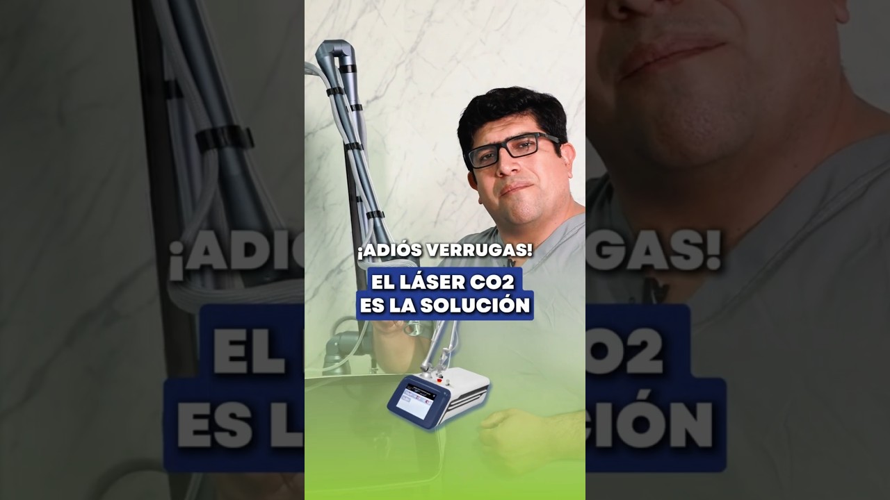 ELIMINA las VERRUGAS por VPH con L&Aacute;SER CO2 🙅😲