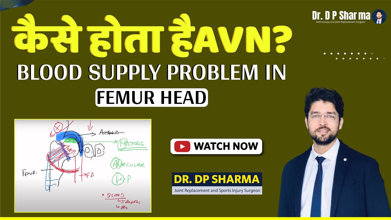 Blood Supply of Femur Head | How Does AVN Happen?  Everything You Need To Know - Dr. DP Sharma