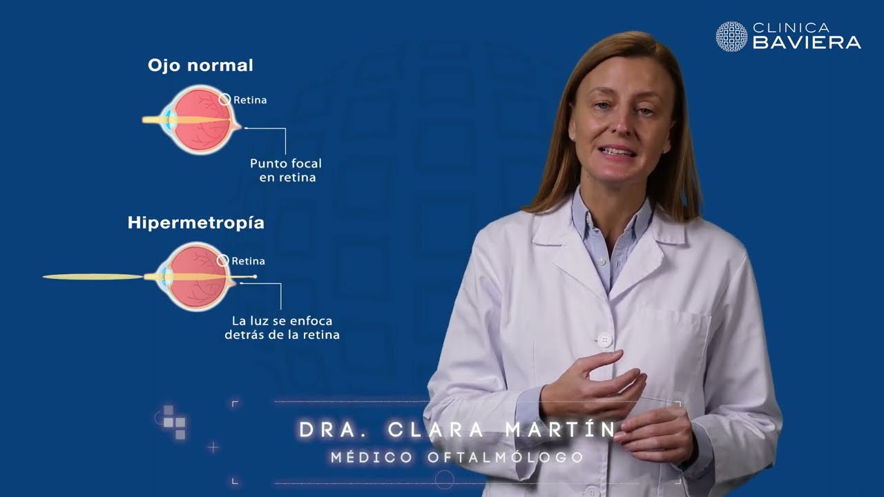¿Qué es la hipermetropía? | Clínica Baviera