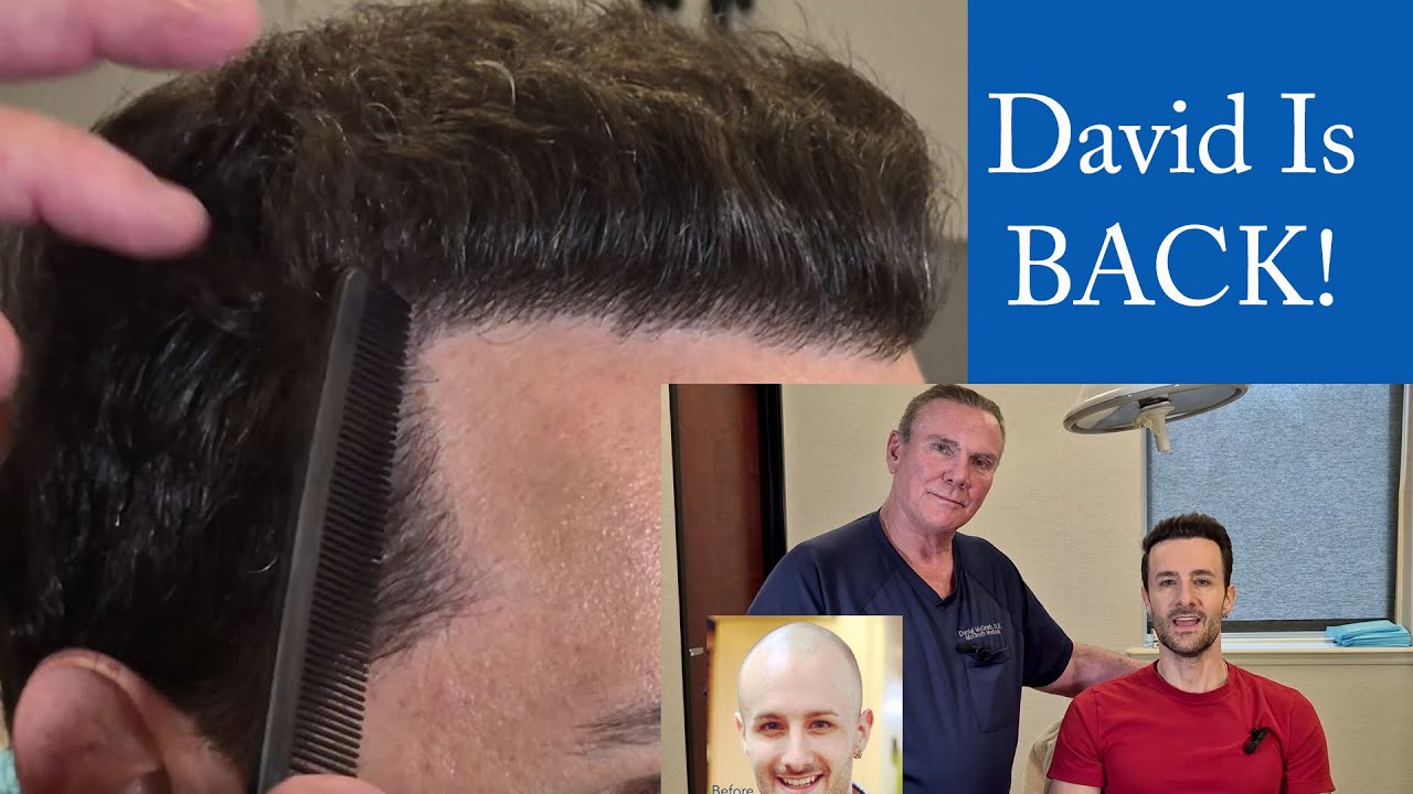 Hair Loss Influencer David DiMuzio visits McGrath Medical in Austin, Texas