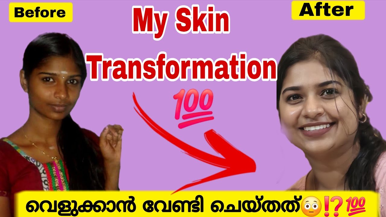 😍💯എന്റെ skin Transformation journey 🔥|Skin Transformation malayalam |Amz vlogs 