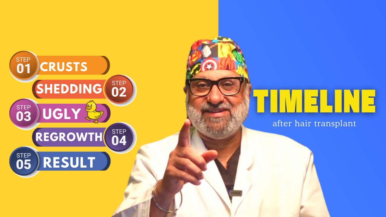 Care after hair transplant | Month-by-Month Timeline