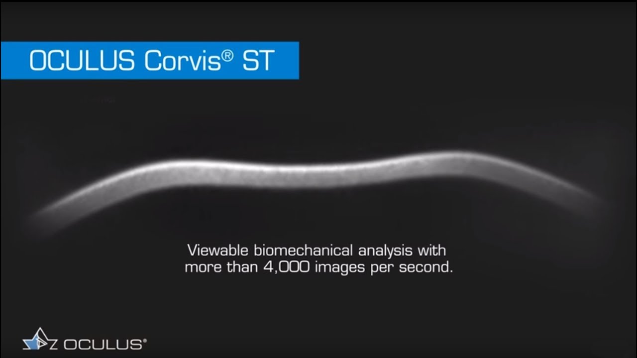 OCULUS Corvis® ST - Ultra high speed images you have never seen before!