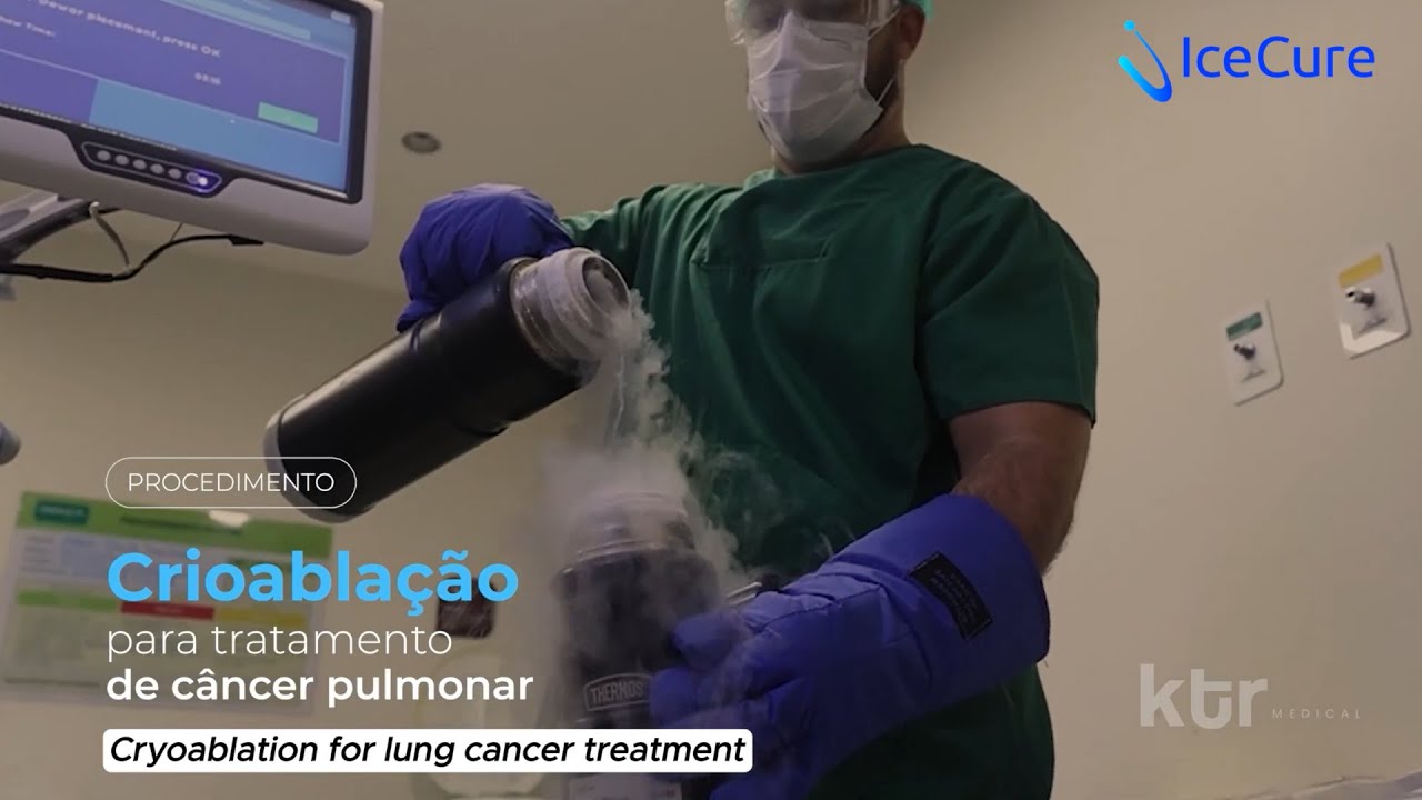 Lung Cryoablation Brazil - Part 1