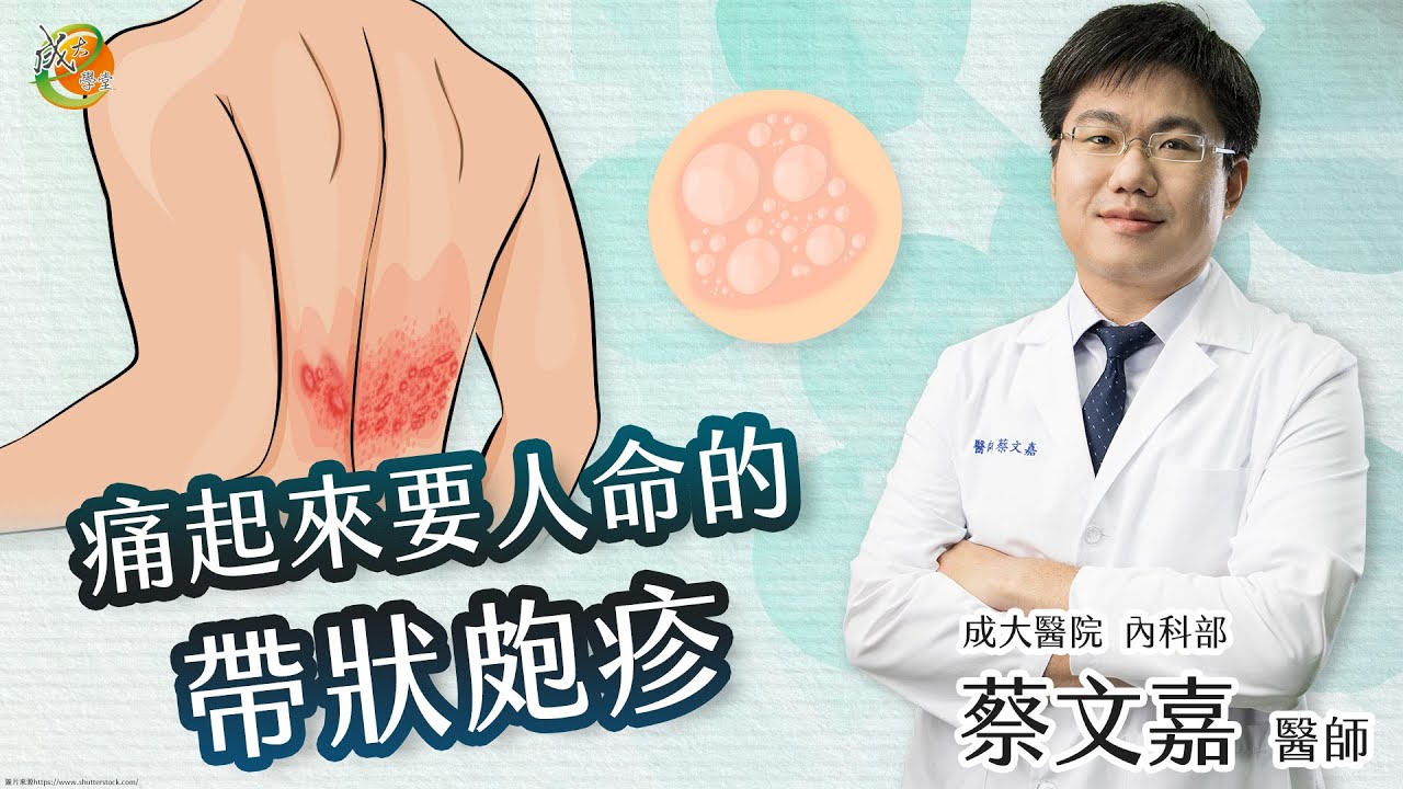 【帶狀皰疹疫苗】蔡文嘉醫師-成大e學堂