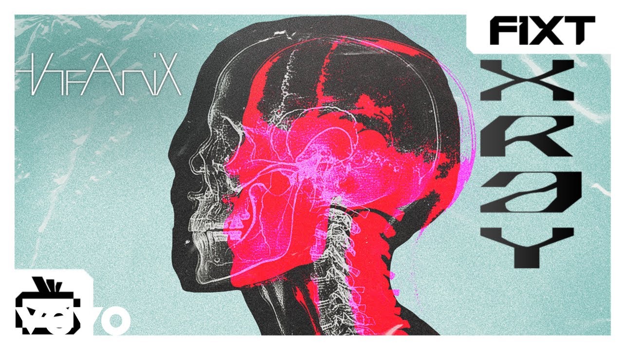 The Anix - XRAY