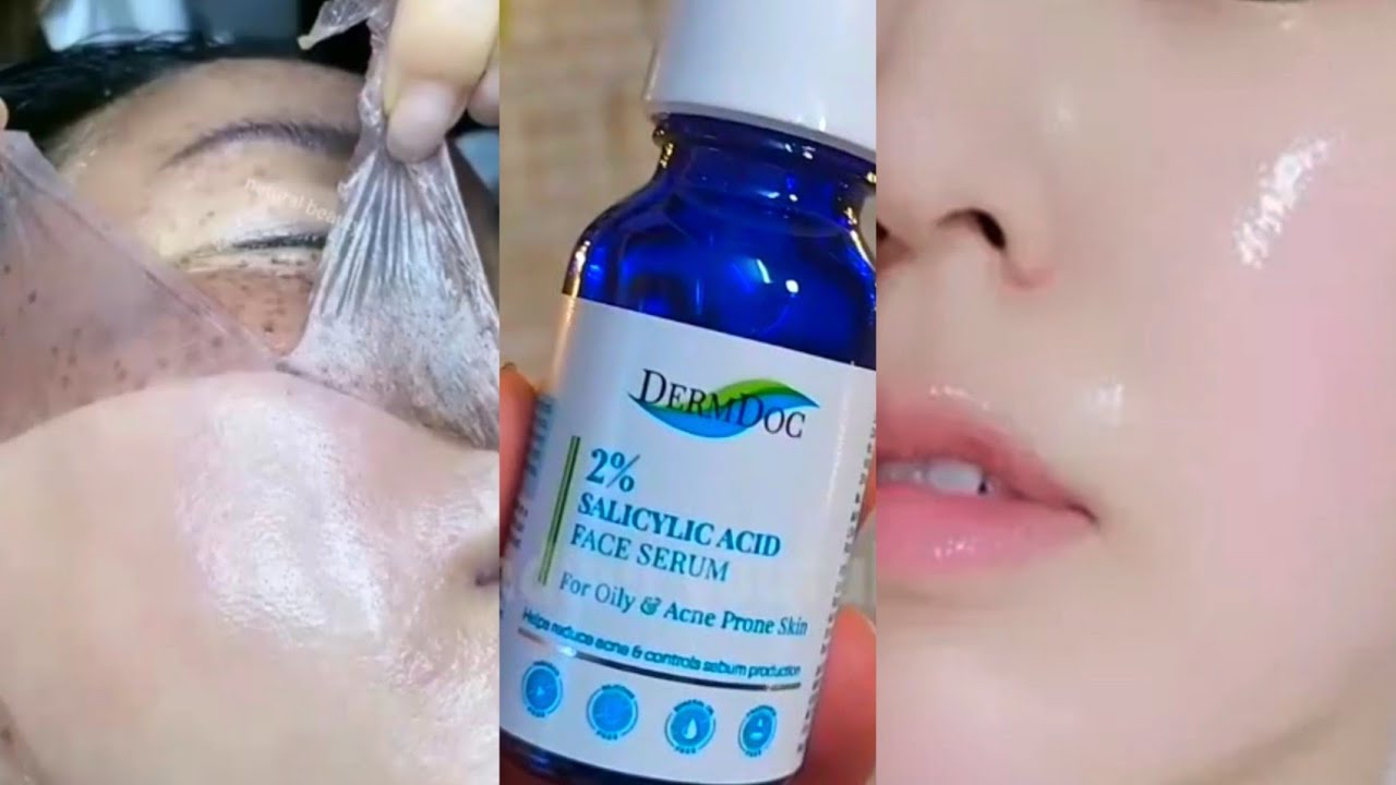 Dermdoc 2% salicylic acid serum for oily and acne prone skin honest review ||DermDoc serum