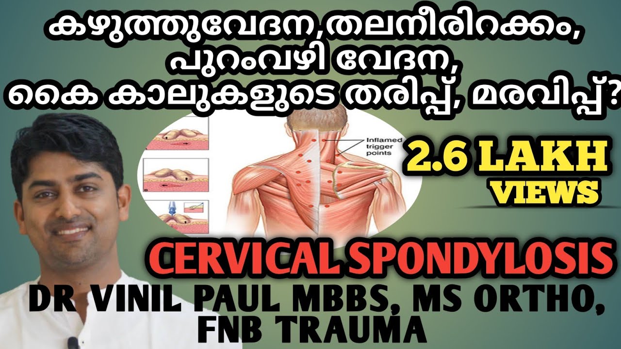 EP11: CERVICAL SPONDYLOSIS | NECK PAIN MALAYALAM | കഴുത്തു വേദന | DR VINIL PAUL | ORTHO TIPS