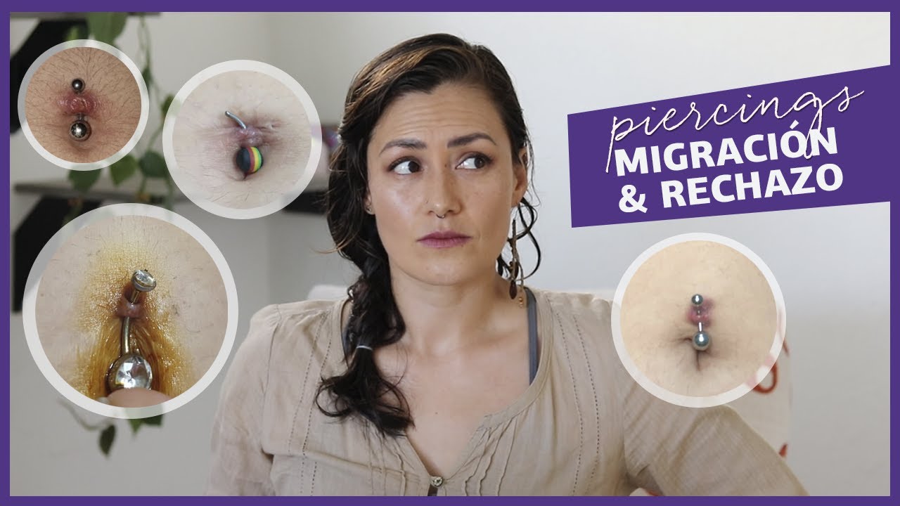 Piercings: migración & rechazo 🥺