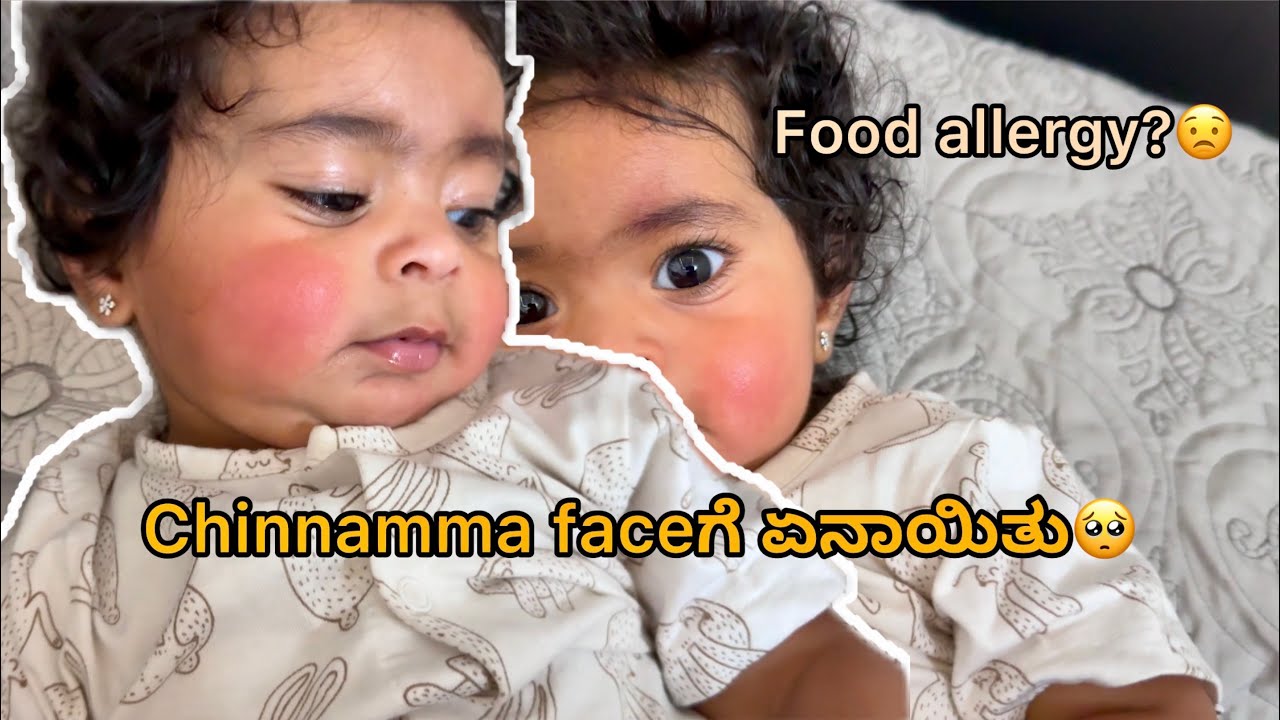 Chinnammaಗೆ allergy?🥺 Abhi surprised me with a gift😍💕🧿 | ArpithaAbhishek