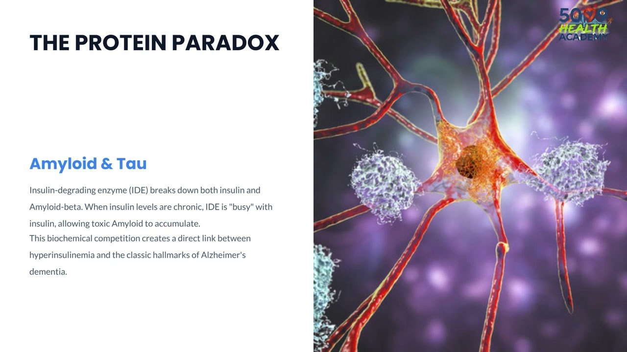 Type 3 Diabetes   Mechanisms and Prevention