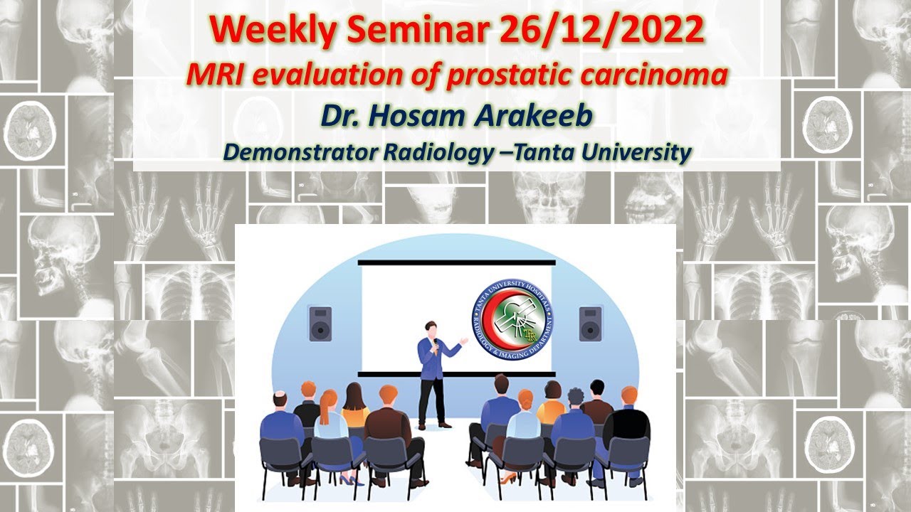 MRI Evaluation of Prostatic Cancer