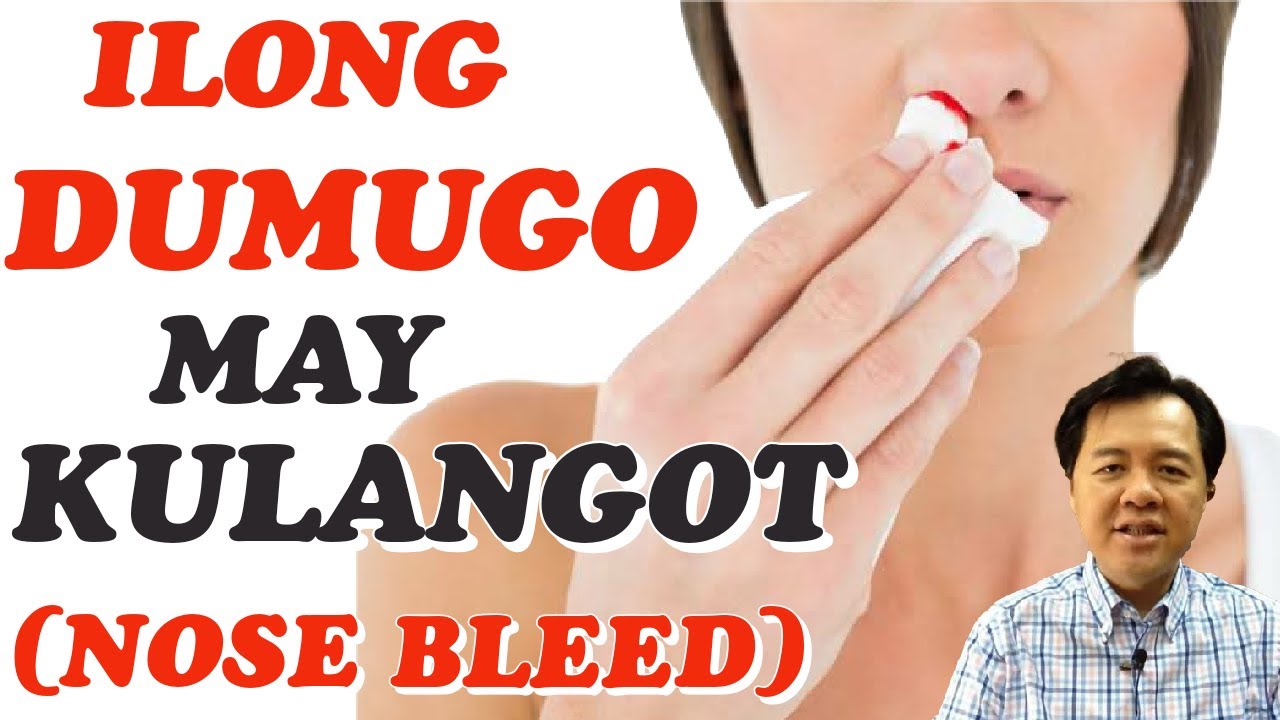 Nose Bleed, Allergy: Simple Home Remedy – by Doc Willie Ong #1000