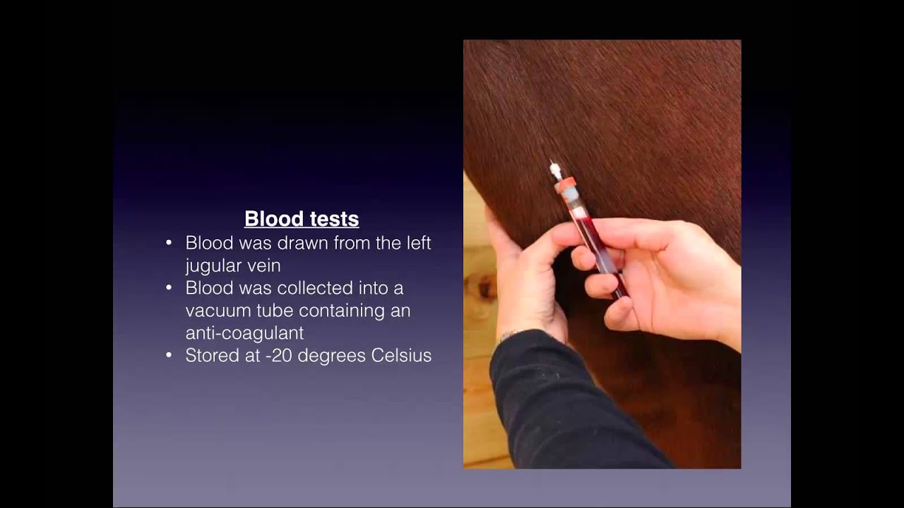 Exercise Demand and Effect on the Synthesis of Plasma Leptin