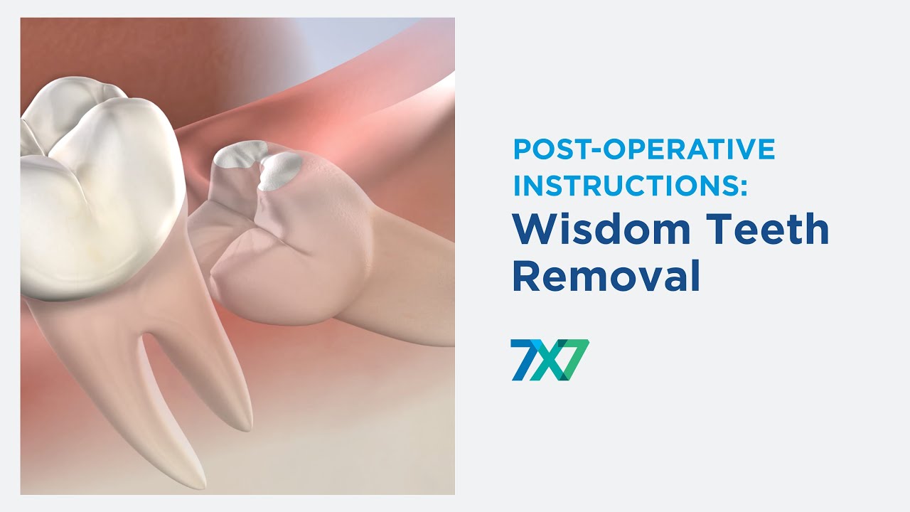 Post-Operative Instructions: Wisdom Teeth Removal | 7x7 Dental Implant & Oral Surgery Specialists