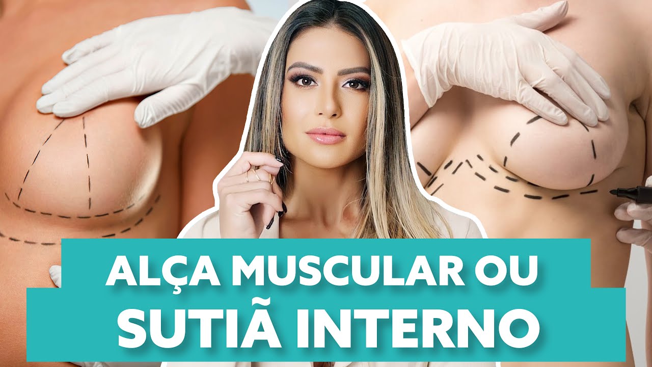 SUTIÃ INTERNO OU ALÇA MUSCULAR? Qual é ideal? | LILI SPADA
