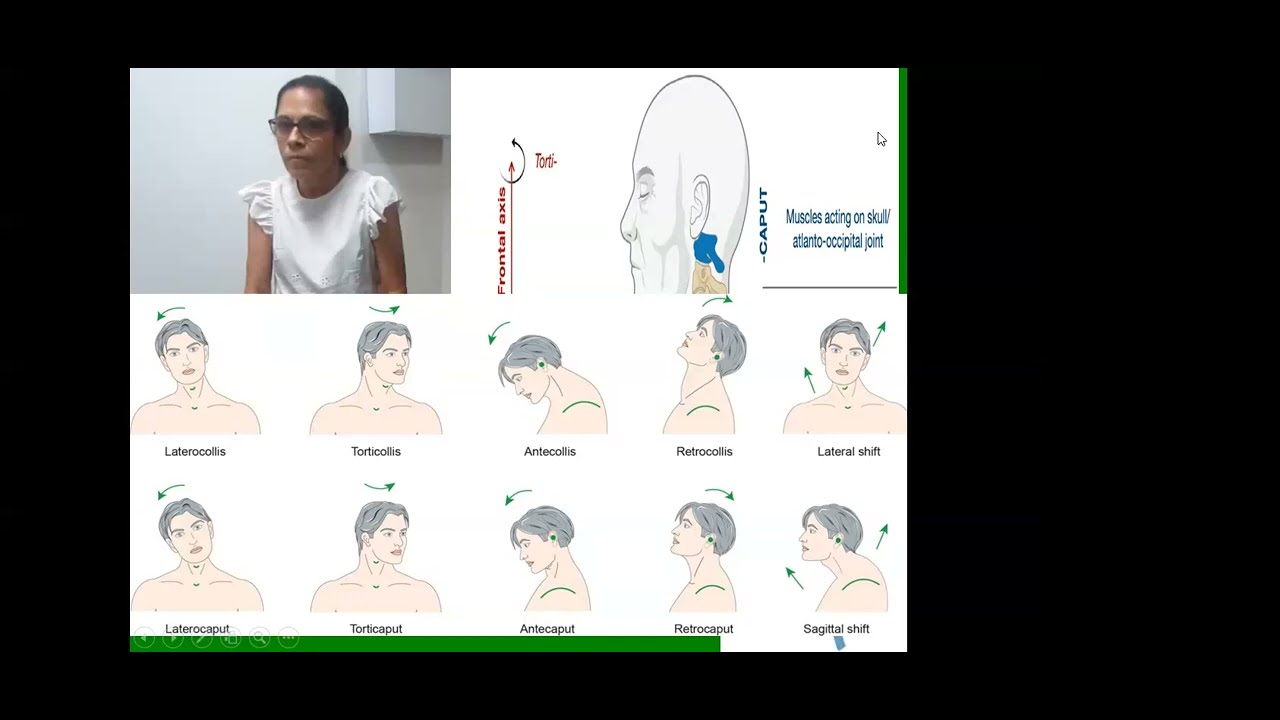 Movimientos anormales. Dr. Luis Ernesto González Sánchez Neurólogo
