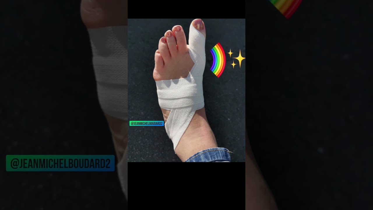 Strapping pour protéger une douleur interne du gros orteil