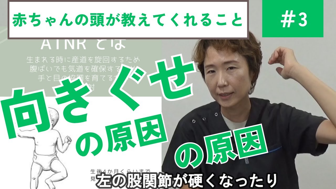 赤ちゃんの頭が教えてくれること③向きぐせの原因｜斜頭・絶壁・短頭・向きぐせ解決