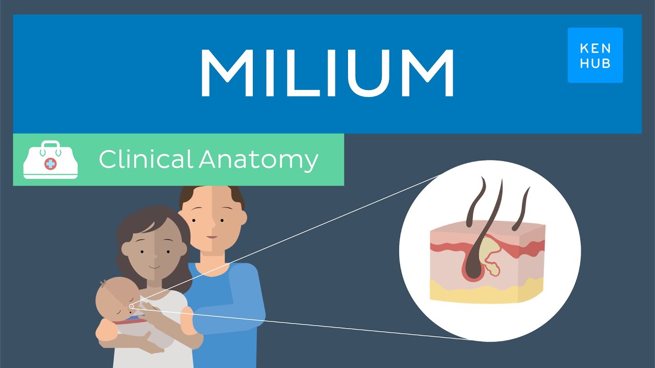 Milium: Definition, symptoms, treatment and management |&nbsp;Kenhub
