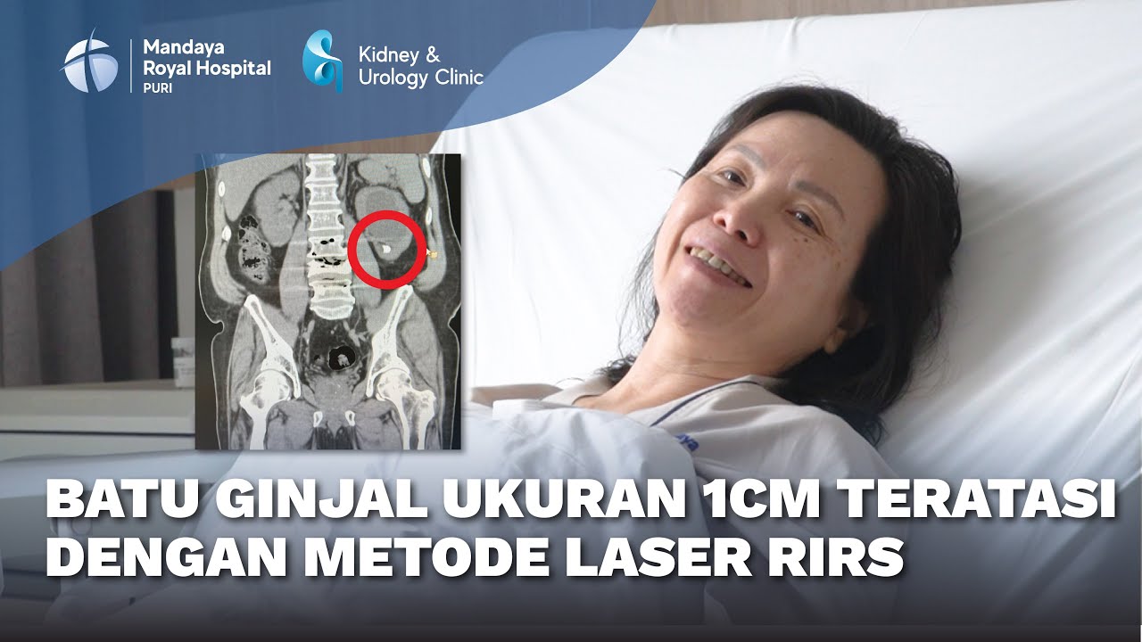 Pengalaman Pasien Batu Ginjal Berukuran 1CM yang Melakukan Tindakan Laser RIRS