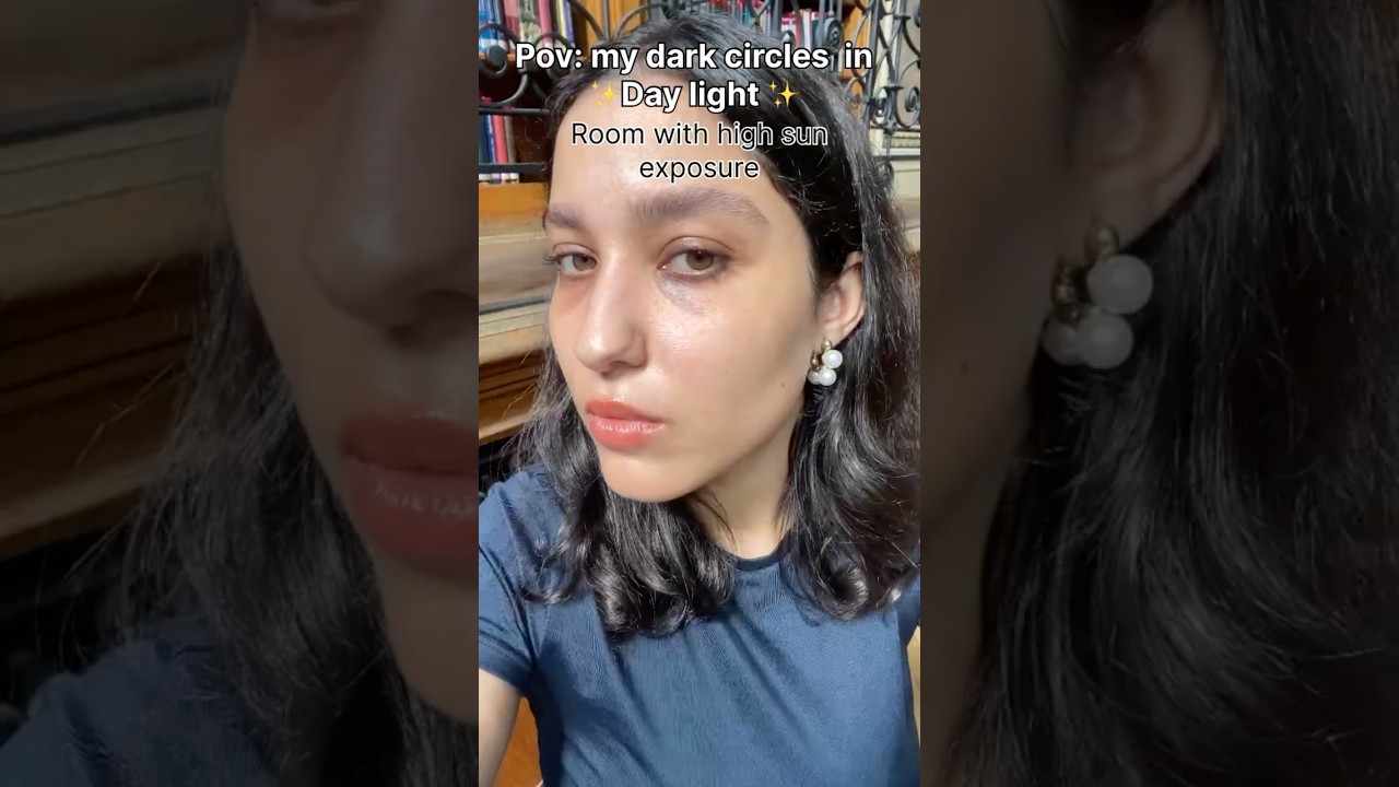 Real dark circles with different lighting 💡#darkcirclesundereyes #darkcircles