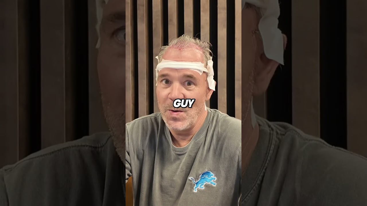 I Went To Turkey For A Hair Transplant!