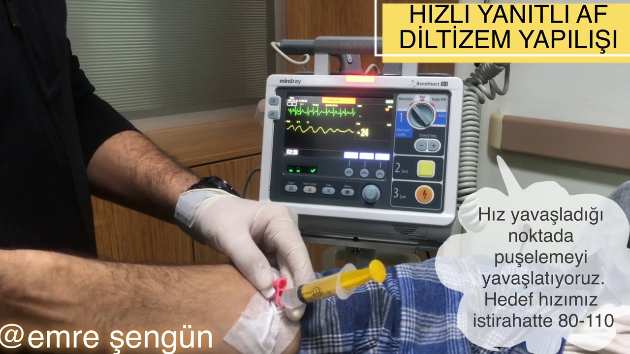 DİLTİZEM-ATRİYAL FİBRİLASYONDA HIZ ÜZERİNE ETKİSİ (HIZ KIRMA)