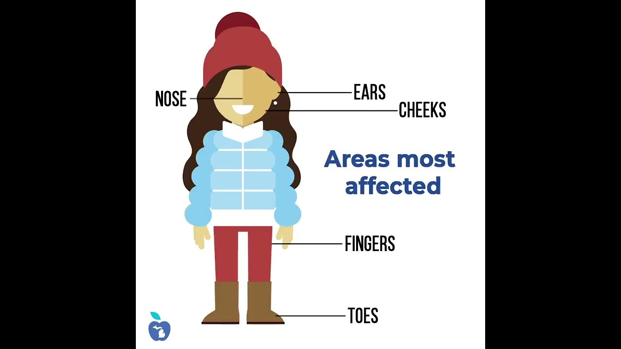 Get the Facts on Frostbite | #shorts