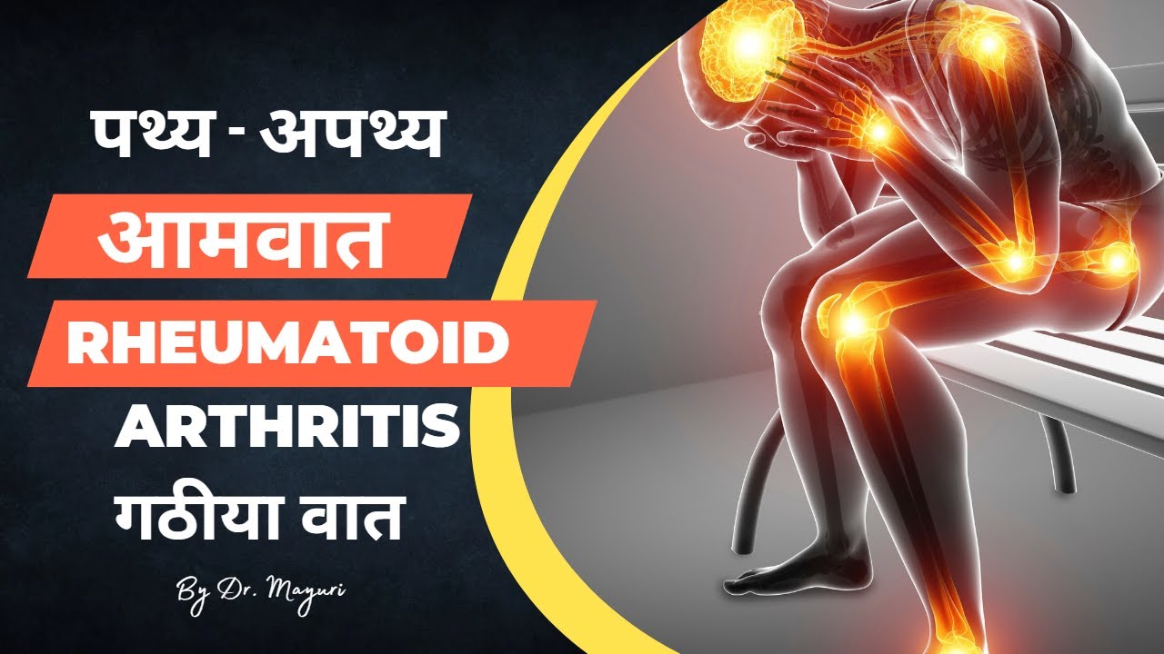 Aamvat me kya khana chahiye aur kya nahi | Do and don'ts in Rheumatoid arthritis@optimistic ayurveda