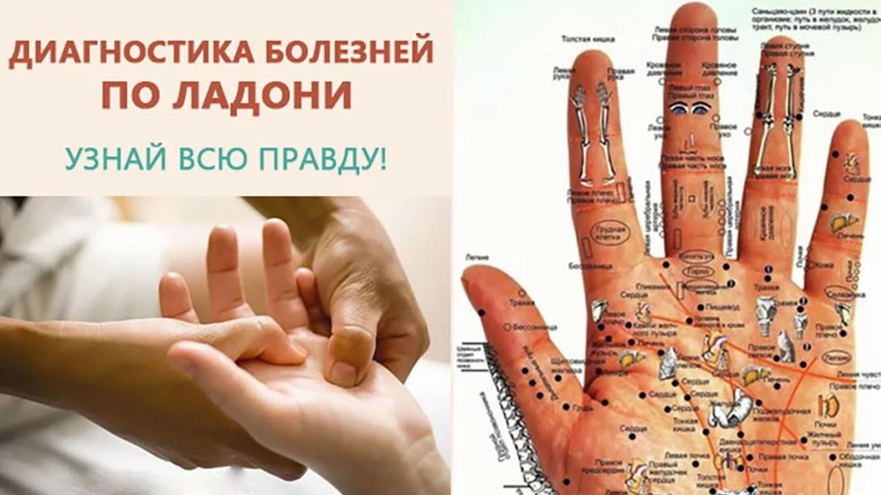 Руки ЧЕЛОВЕКА - КЛАДЕЗЬ всевозможной информации! Диагностика БОЛЕЗНЕЙ по ЛАДОНЯМ!