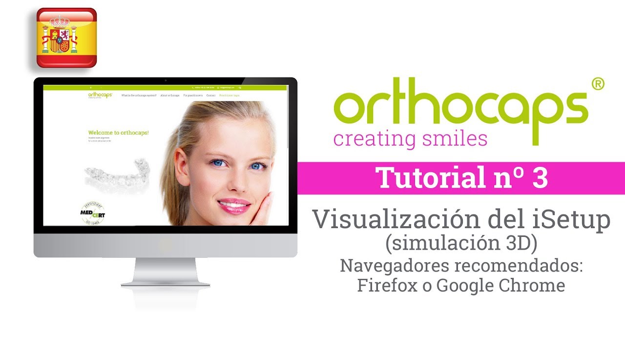 Orthocaps tutorials. Visualización del iSetup