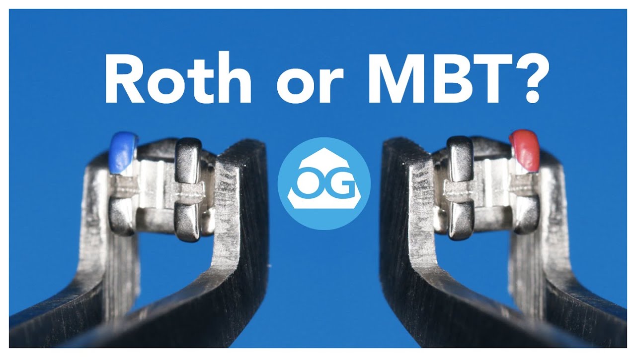 Roth or MBT? We do have an answer!