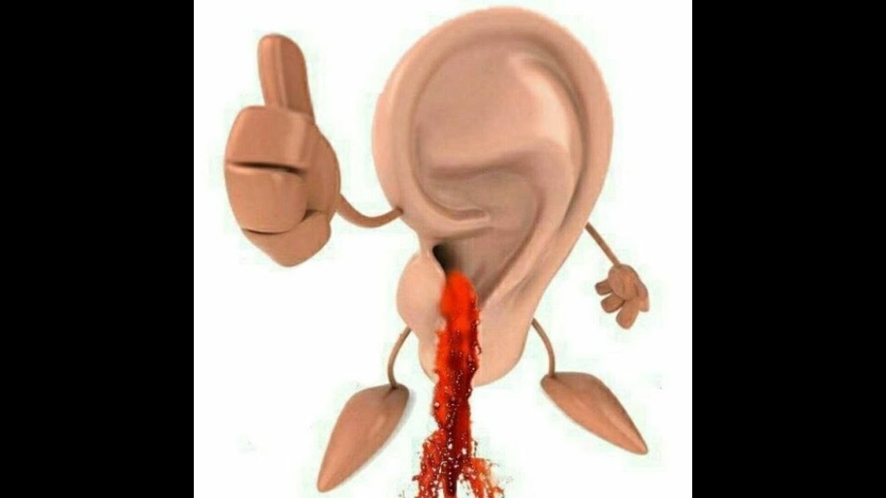 네고막을지키지못해미안허다......