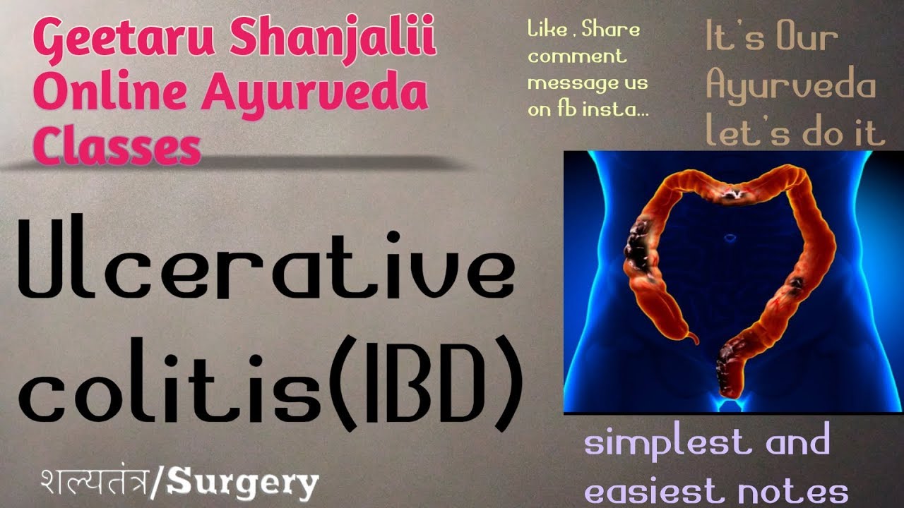 Ulcerative colitis IBD by Geetaru #Shanjalii #bams #Gitaru #shalytantra #Ayurved #surgery UG subject