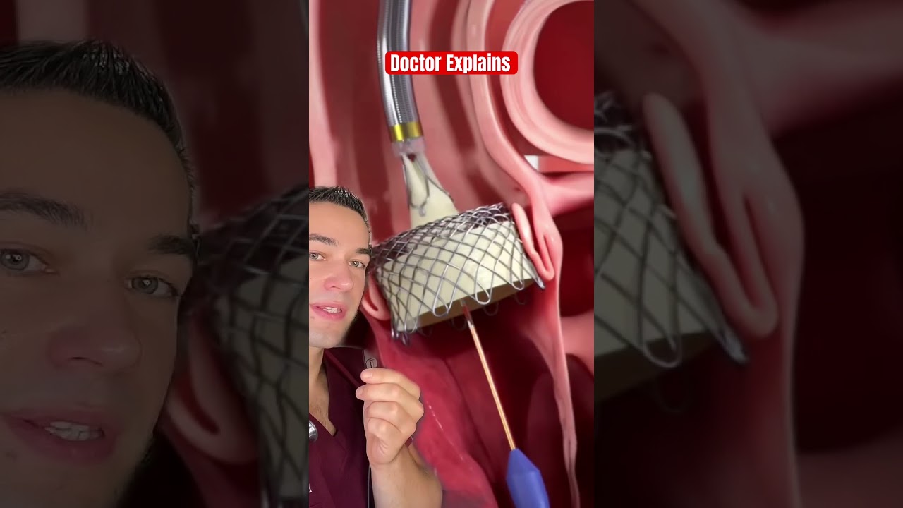 Doctor reacts to life saving procedure
