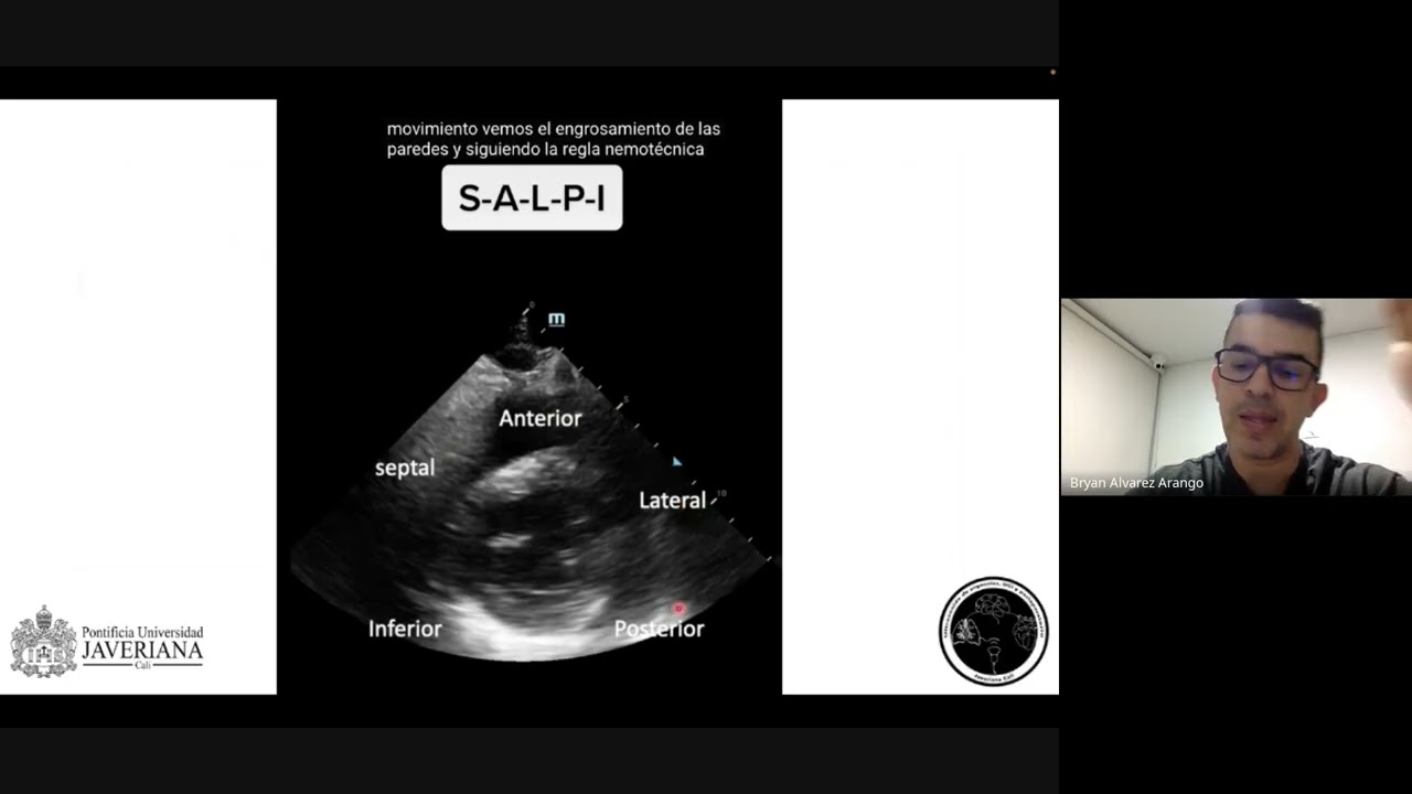 ¡POCUS salva vidas! Cómo detectar un infarto en segundos con ecografía a pie de cama