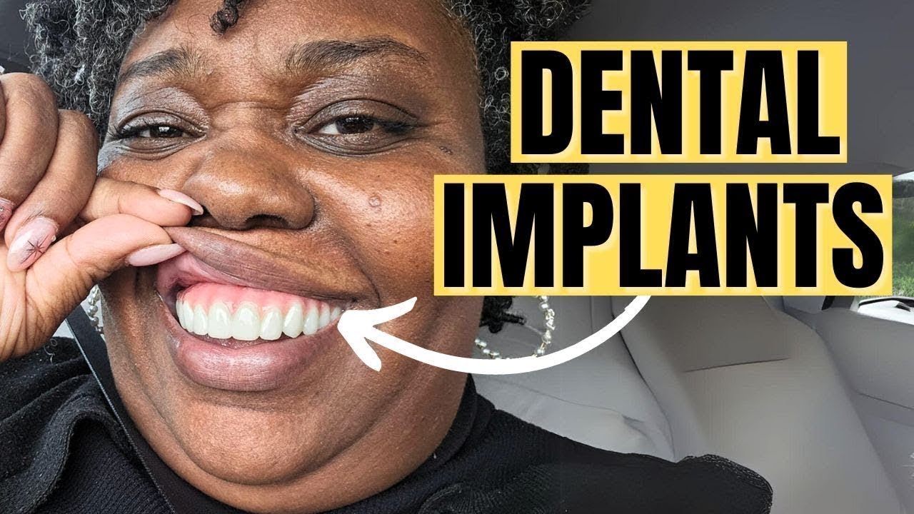 How I AVOIDED Fake-Looking Teeth