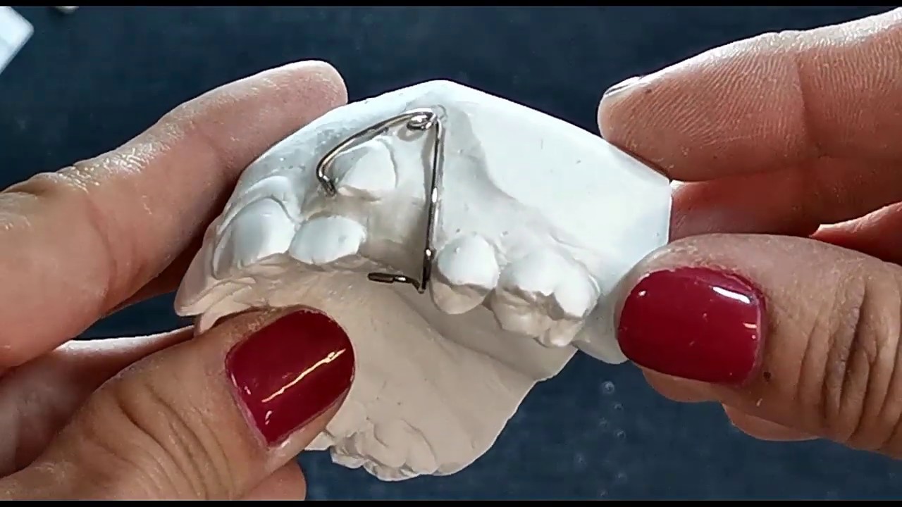 RETRACTOR DE CANINO ORTODONCIA REMOVIBLE