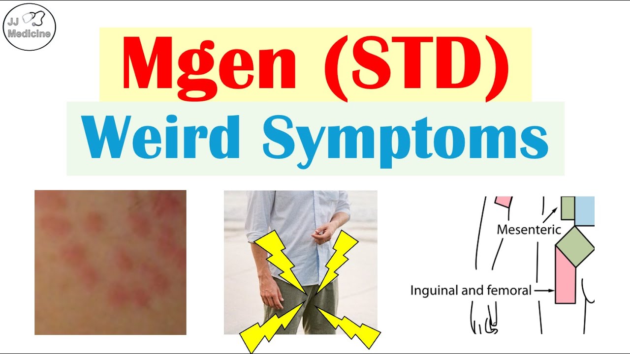 The STD You’ve Never Heard Of: Weird Symptoms of Mgen (Doctors Miss These)