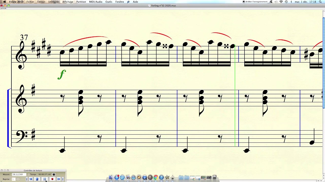 Projet FERLING Etude n°32