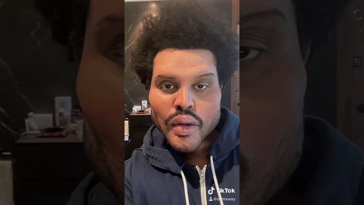 The Weeknd&rsquo;s Plastic Surgery Before and After! (MUST WATCH) | tiktok edition 😭‼️ read description