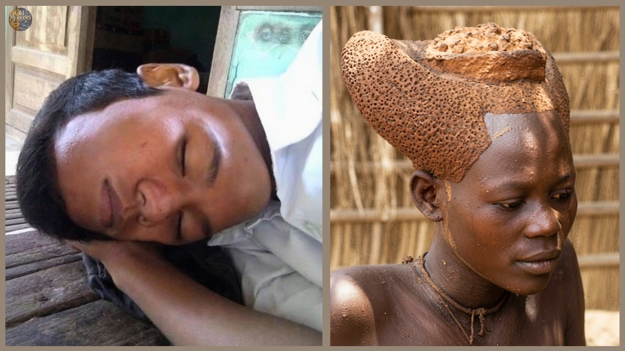 12 People With Different Bodies and Unbreakable Courage &ndash; Rare People
