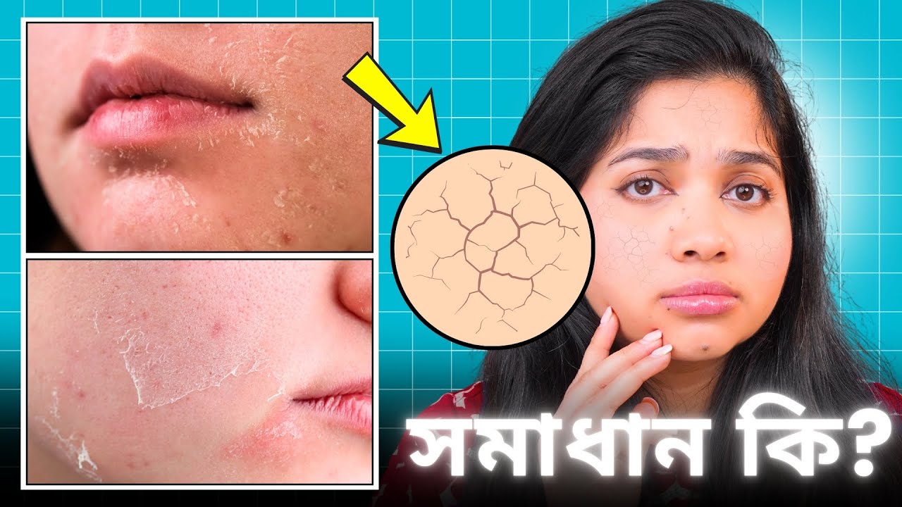 শুষ্ক ত্বকের যত্নে ১০টি জরুরি টিপস । 10 Tips To Treat Dry Skin