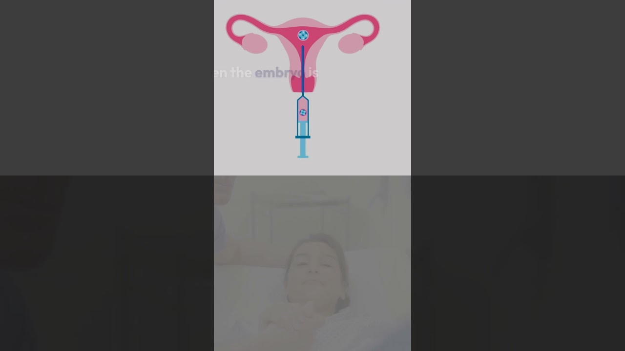 IVF - step by step!