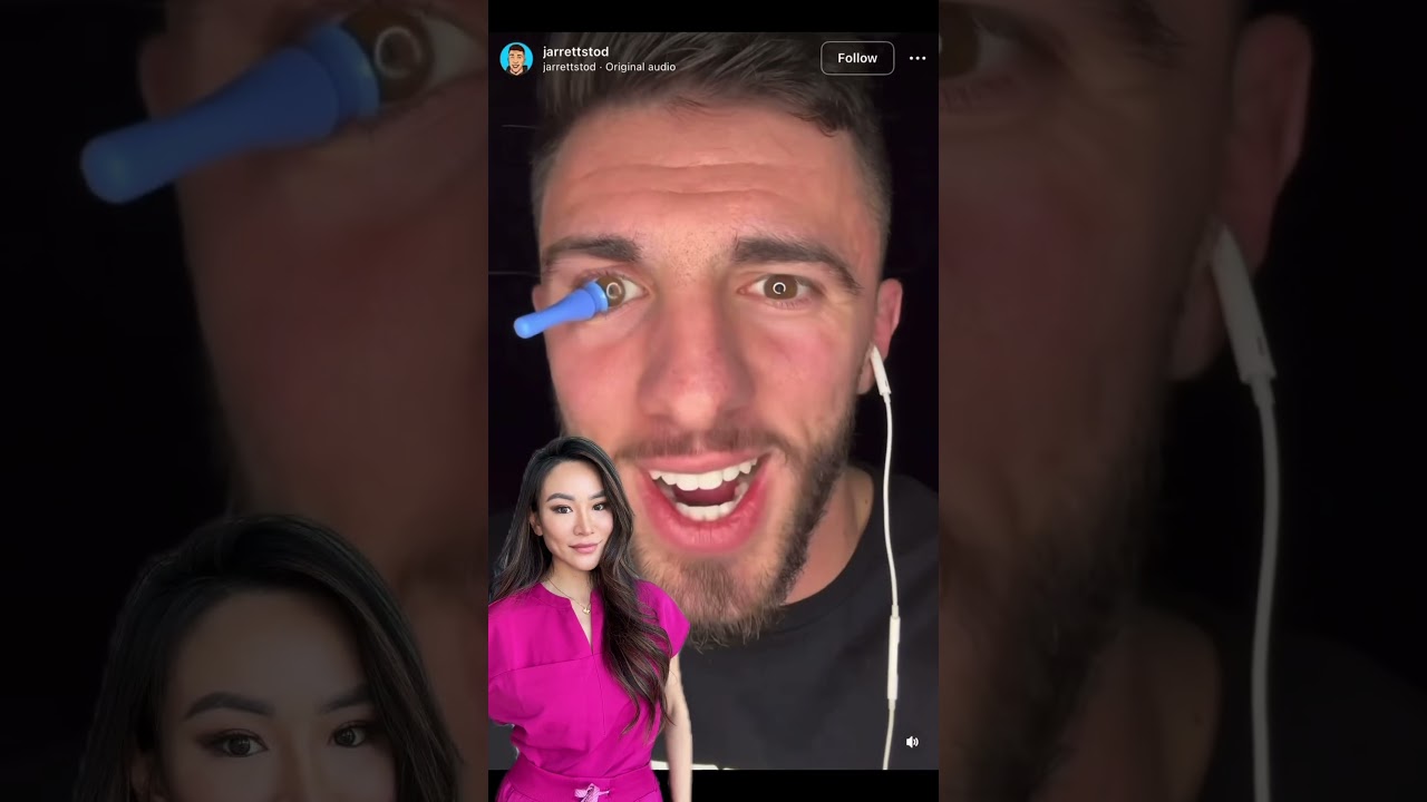 Wearing a prosthetic eye #health #eyes #viral #contactlenses #trending